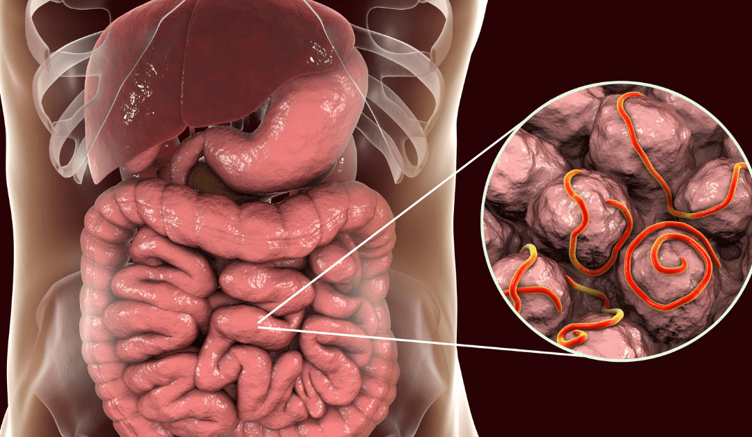 Common Signs of Parasite Overgrowth in the Body: How Functional Medicine Can Help
