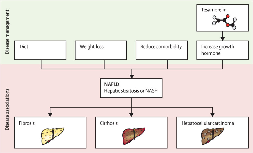 Tesamorelin Fatty Liver Graphic