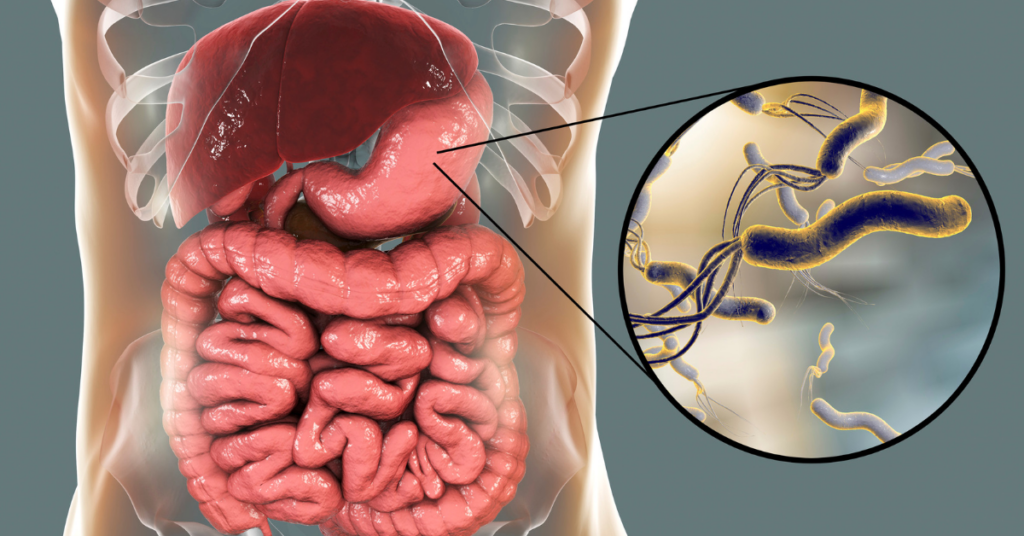 10 Common Signs of Parasite Overgrowth in the Body (2)