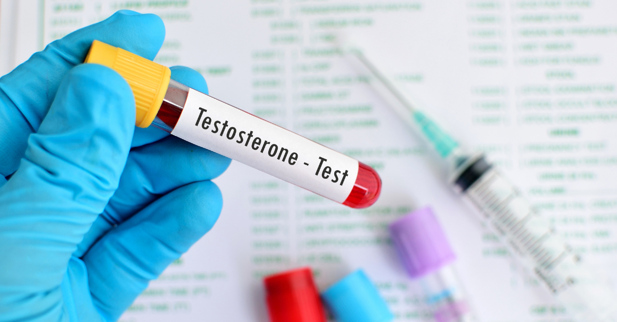 Low Testosterone: Symptoms, Causes, Diagnosis, and Treatment Options