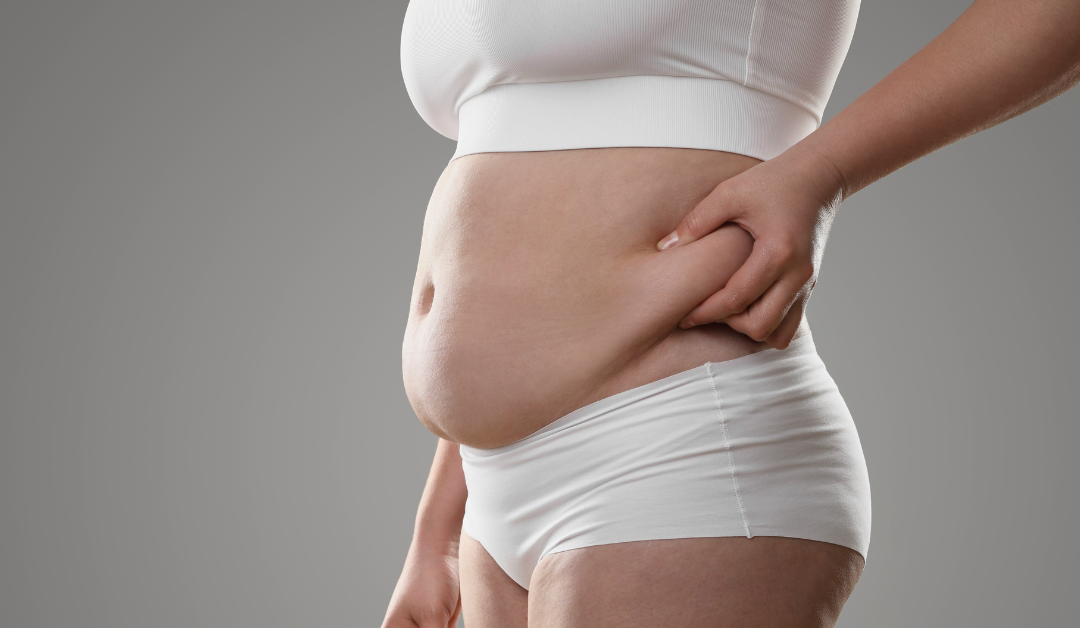 Cortisol Belly Fat: Why Stress Stores Fat in Your Midsection