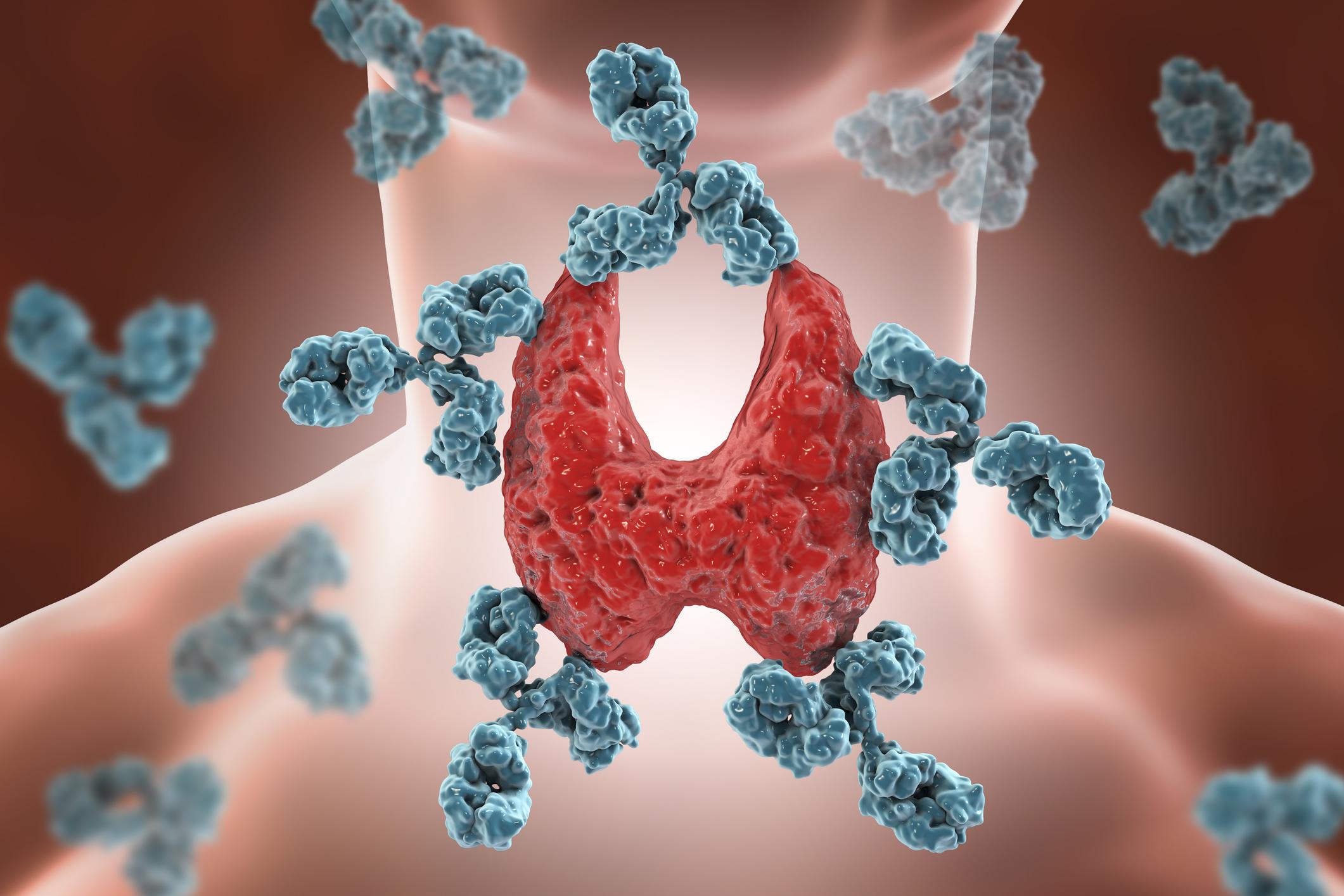 Hashimoto’s vs. Hypothyroidism: What’s the Difference?